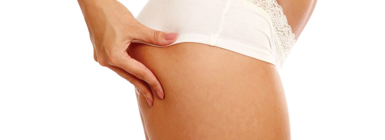 Celulitis