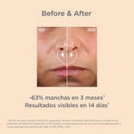 ISDINCEUTICS Melaclear Advanced
Dark spot correcting serum with tranexamic acid