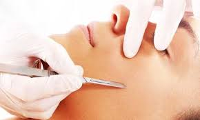 Dermaplaning